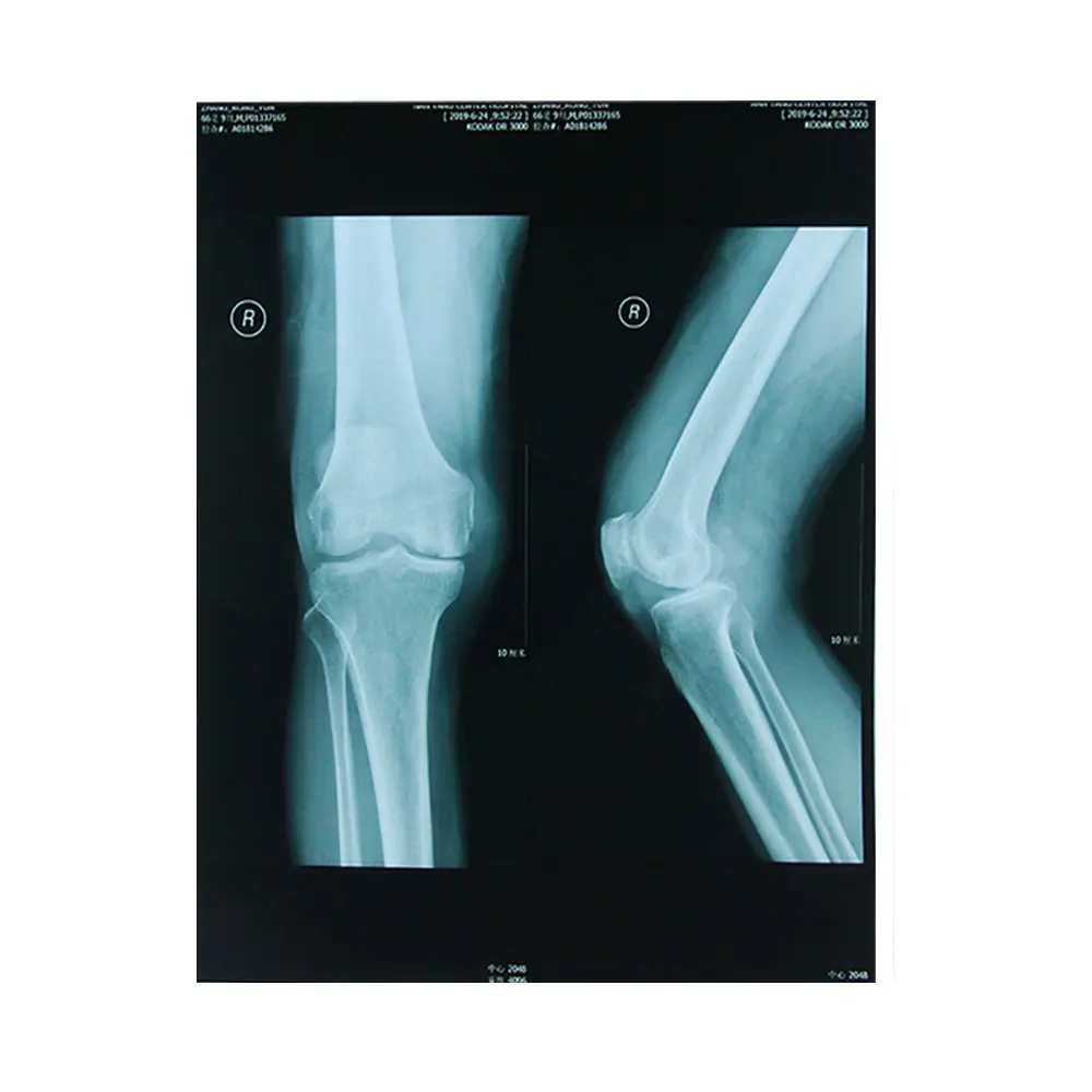 
Wholesale medical dry x-ray film fujifilm DI-HL dry laser imaging film 