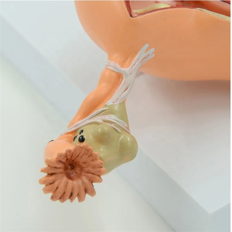 Factory Educational equipment female human anatomy uterine lesion model PVC anatomical model