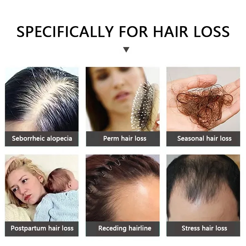 High Quality Private Label Hair Growth Anti Hair Loss Serum Fall Ginger Hair Growth Oil