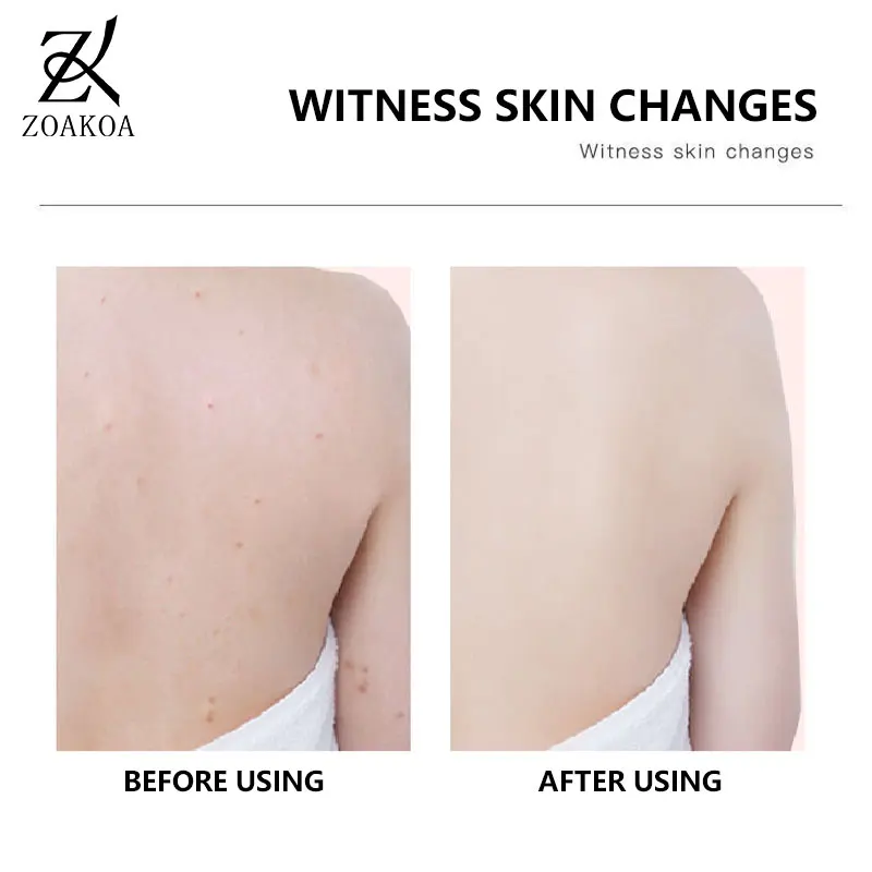 Private Label damaged hair organic shampoo anti-dandruff hair shampoo for men women