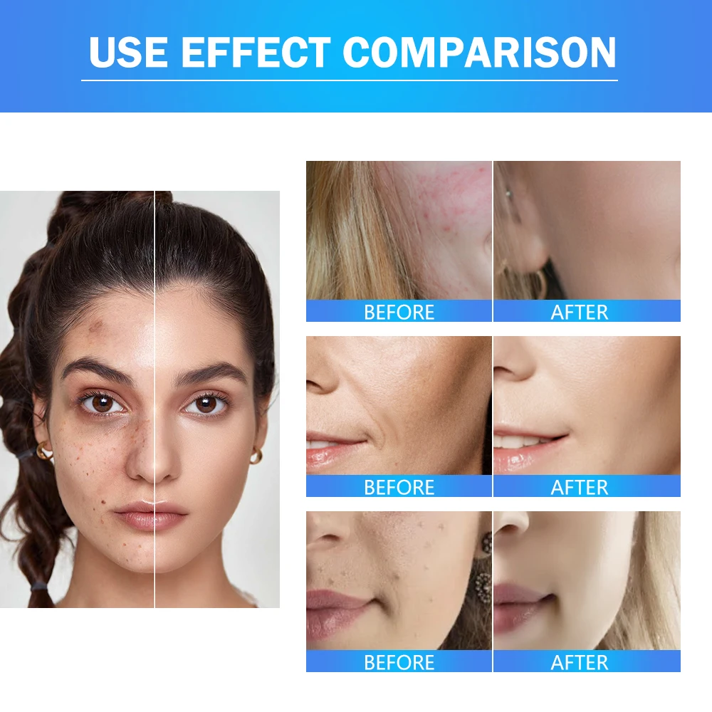 Private Label Organic Glycolic Acid Toner Brightening Toner Promote The Synthesisof Collagen,Reduce Acne And Pits