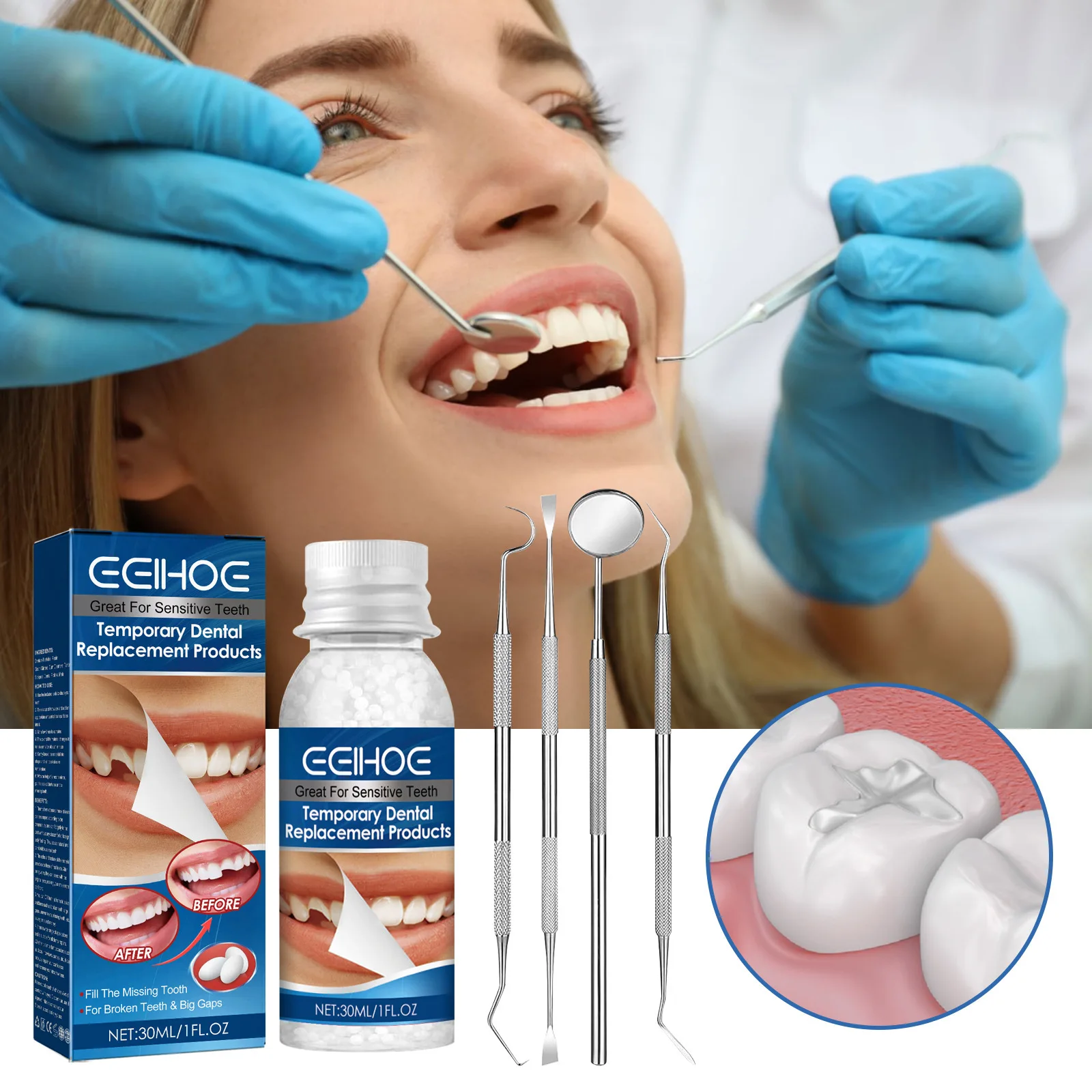 EELHOE False Teeth Solid Glue Teeth Dental Filling Temporary Tooth Repair Kit