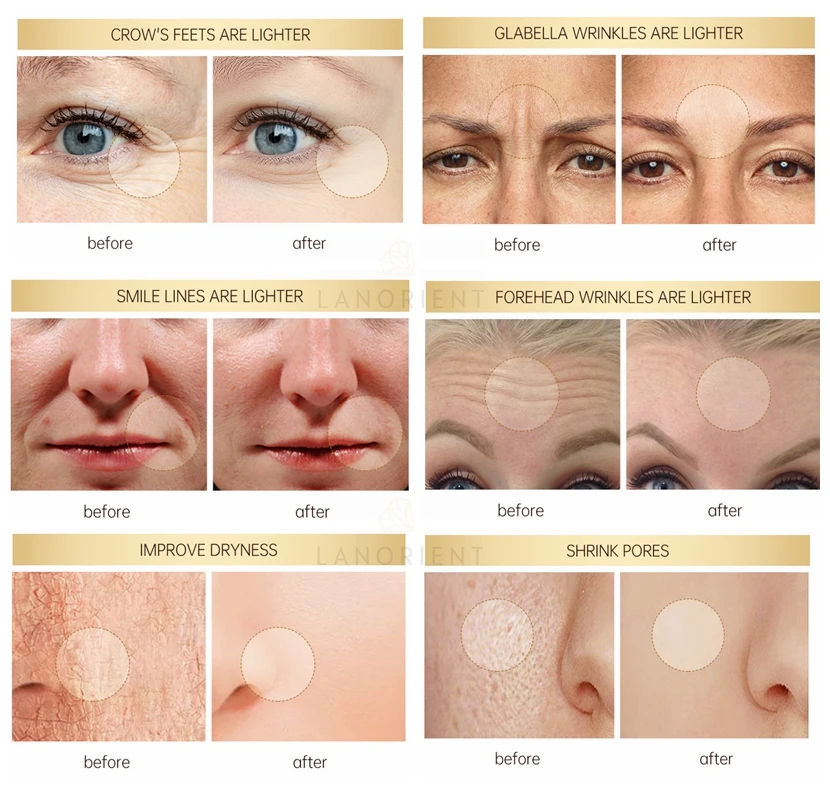 OEM best Arbutin Retinol anti aging bleaching lightening creams without hydroquinone  night cream and day cream set