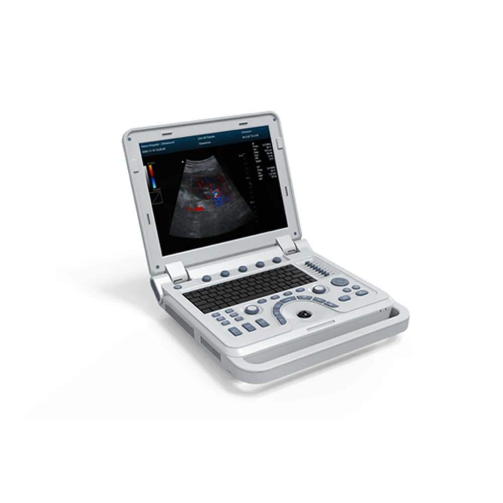 Contec CMS600P2PLUS portable ultrasound machine pseudo Color Doppler Ultrasonic Diagnostic System