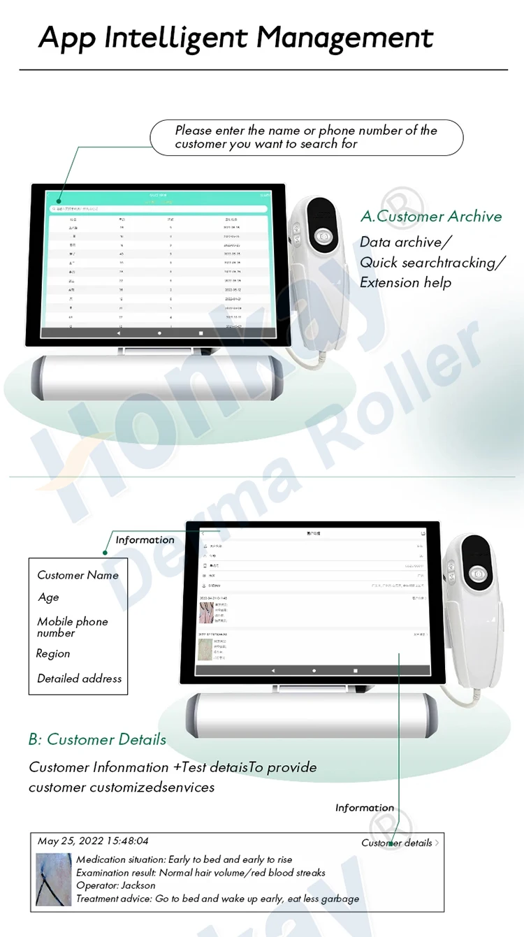 Honkay USB Scalp Analyzer Scanner Machine Home Use Hair Follicle and Scalp Analyzer Equipment USB Plug US/UK Type
