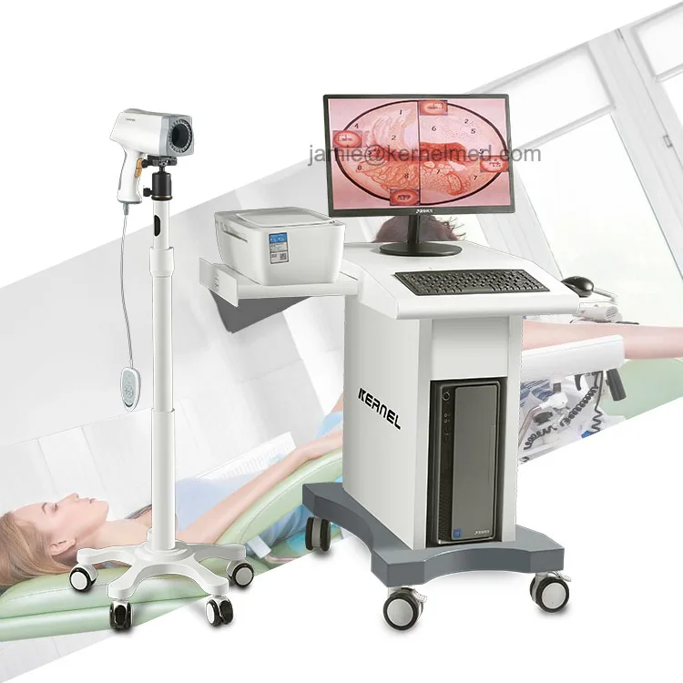Colposcopio Kernel KN-2200 Vagina Digital Optic Portable Video Colposcope Camera Colposcop with HD CCD for Gynecology