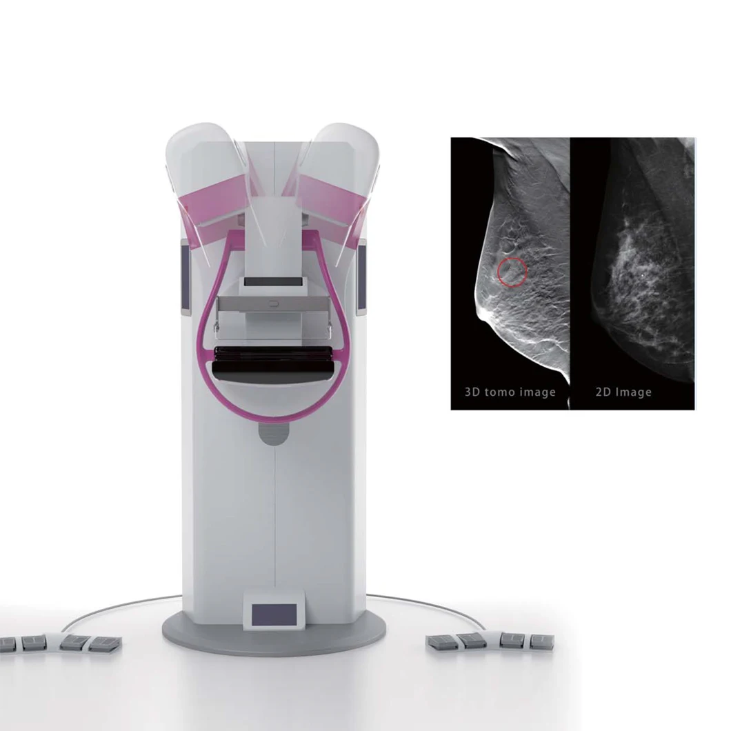 Professional Hospital Use HDM-3000A  High Frequency TOMO Digital Mammography System For Mammography