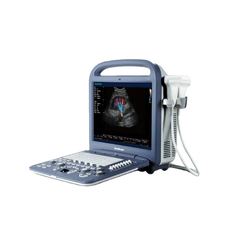 animal handheld sonoscape veterinary ultrasound  machine pregnancy vet touch screen veterinary ultrasound
