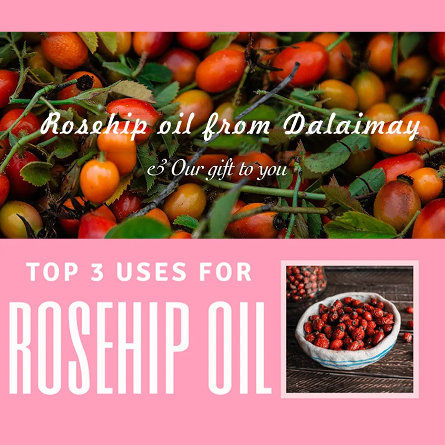 Wholesales Firming Brightening Moisturizing Smoothing Face Skin Hair Organic Cold Pressed Pure and Natural Rosehip Oil