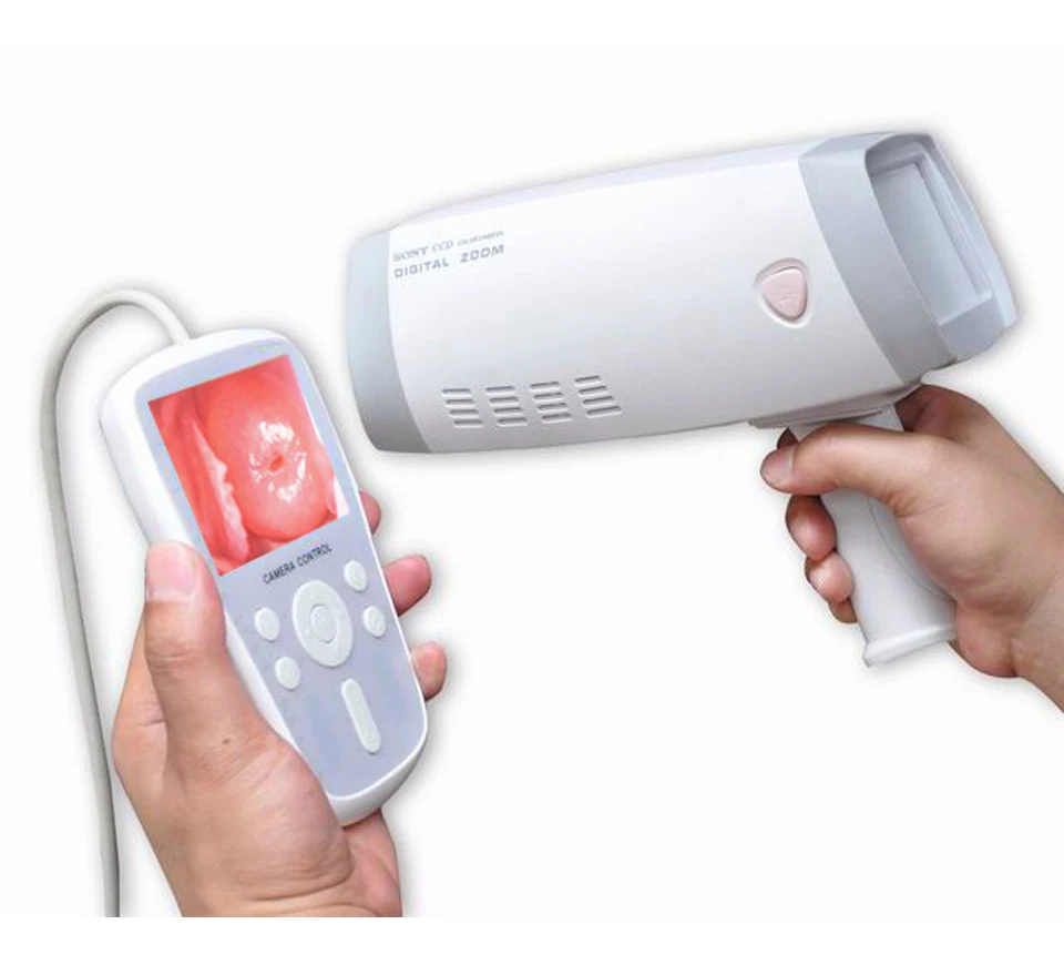 
Portable Handheld Video Colposcope / full hd camera for vagina colposcope 