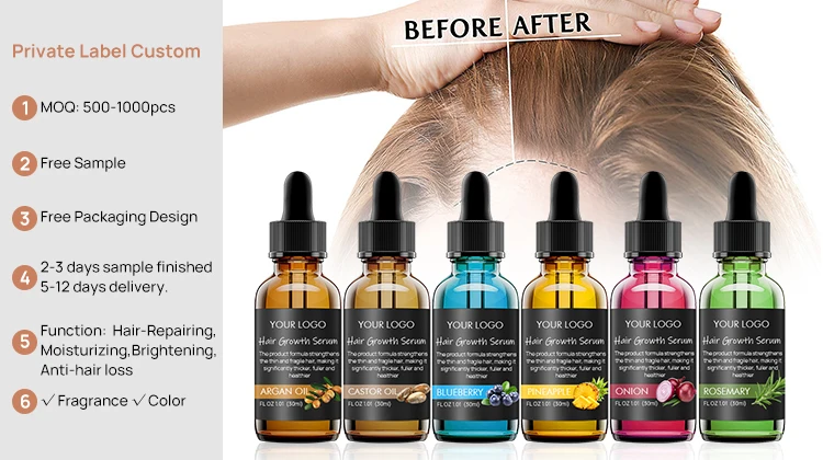 Private Label Organic Moisturizing Nourishing Anti Hair Lose Black Seed Red Onion Growth Oil Serum For Hair Growth