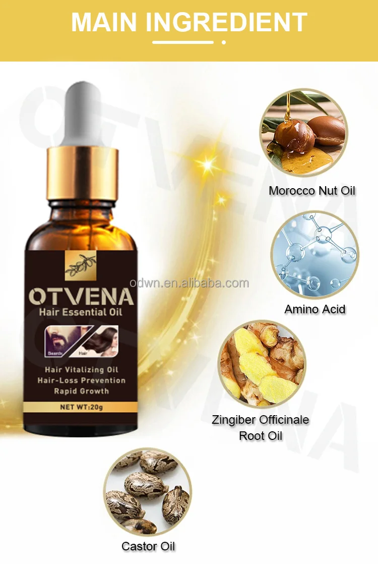 Women Men Anti Hair Loss Treatment Organic Ginger Hair Growth Oil For Hair Regrowth Spray