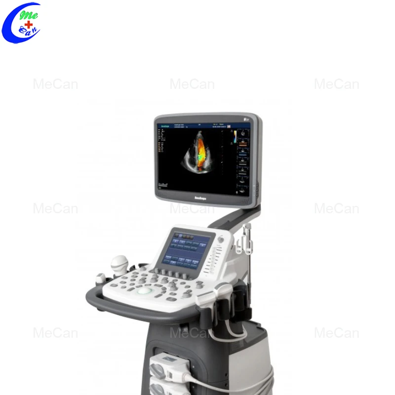 Sonoscape S22 Ultrasound, Sonoscape S22 Best Price,Sonoscape S22 Best Support