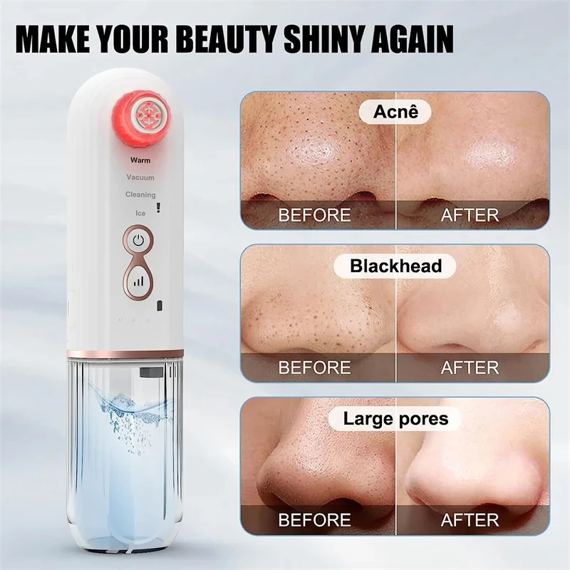 Blackhead Pore Vacuum Cleaner Remover Machine Dead Skin Electric Acne Remove Blackheads Suction Extractor Tool Kit Rechargeable