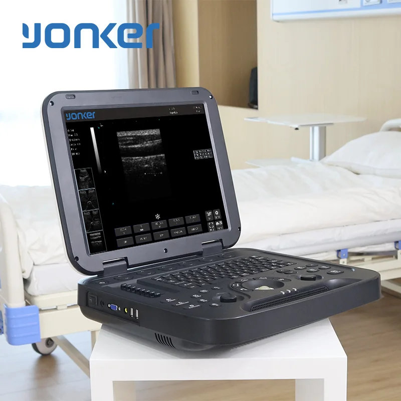Yonker Portable Ultrasound Devices Mobility Meets Medicine ultrasound machine