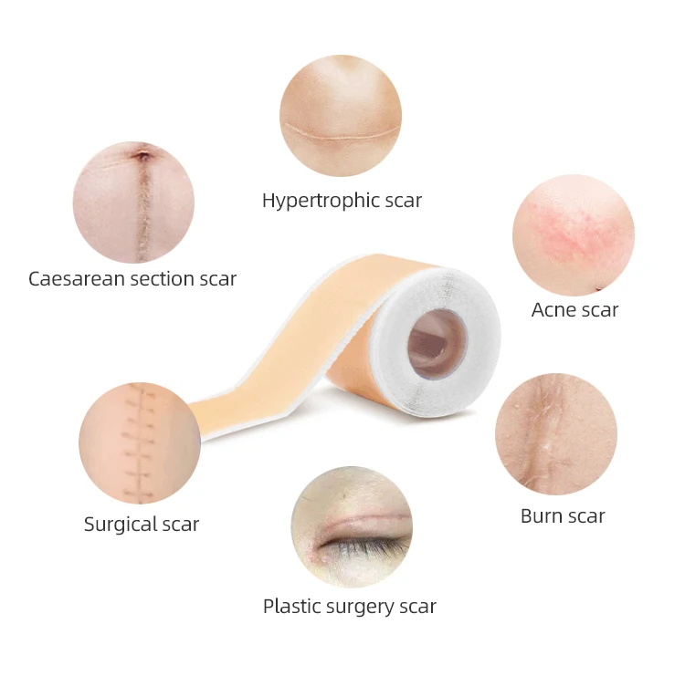 Reusable and Washable Removal Silicone Scar Tape for Softening and Flattening Scars