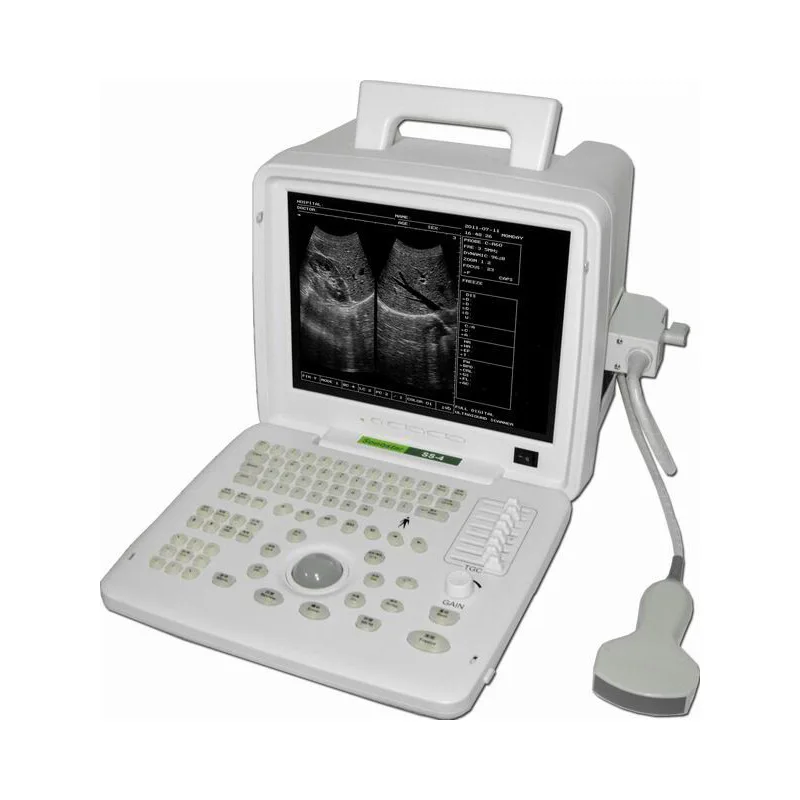 Portable B-mode Ultrasound Machine Portable B-mode Ultrasound Machine B scan device