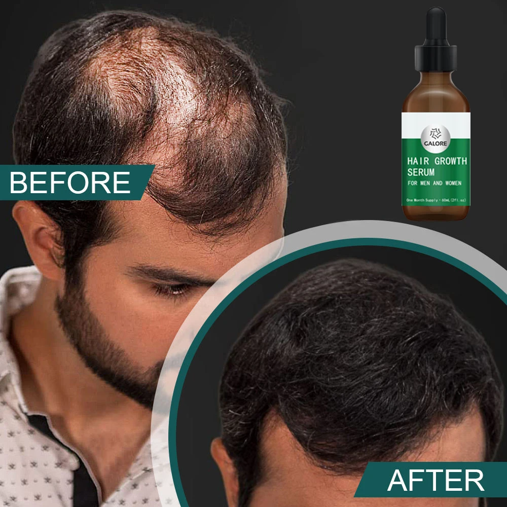 100% Natural   Hair Growth Serum Private Label mix herbs  Oil for Men and Women