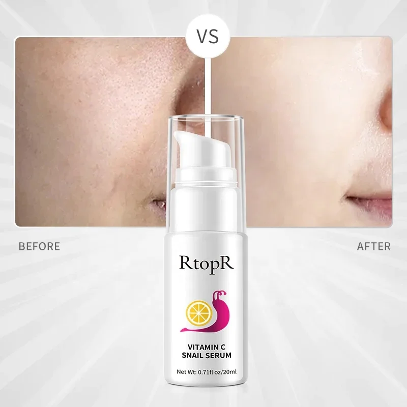 RtopR Snail Vitamin c Serum Anti-Aging Shrink Pore Whitening Moisturizing Essence Oil Control Face Serum Skin Care Products
