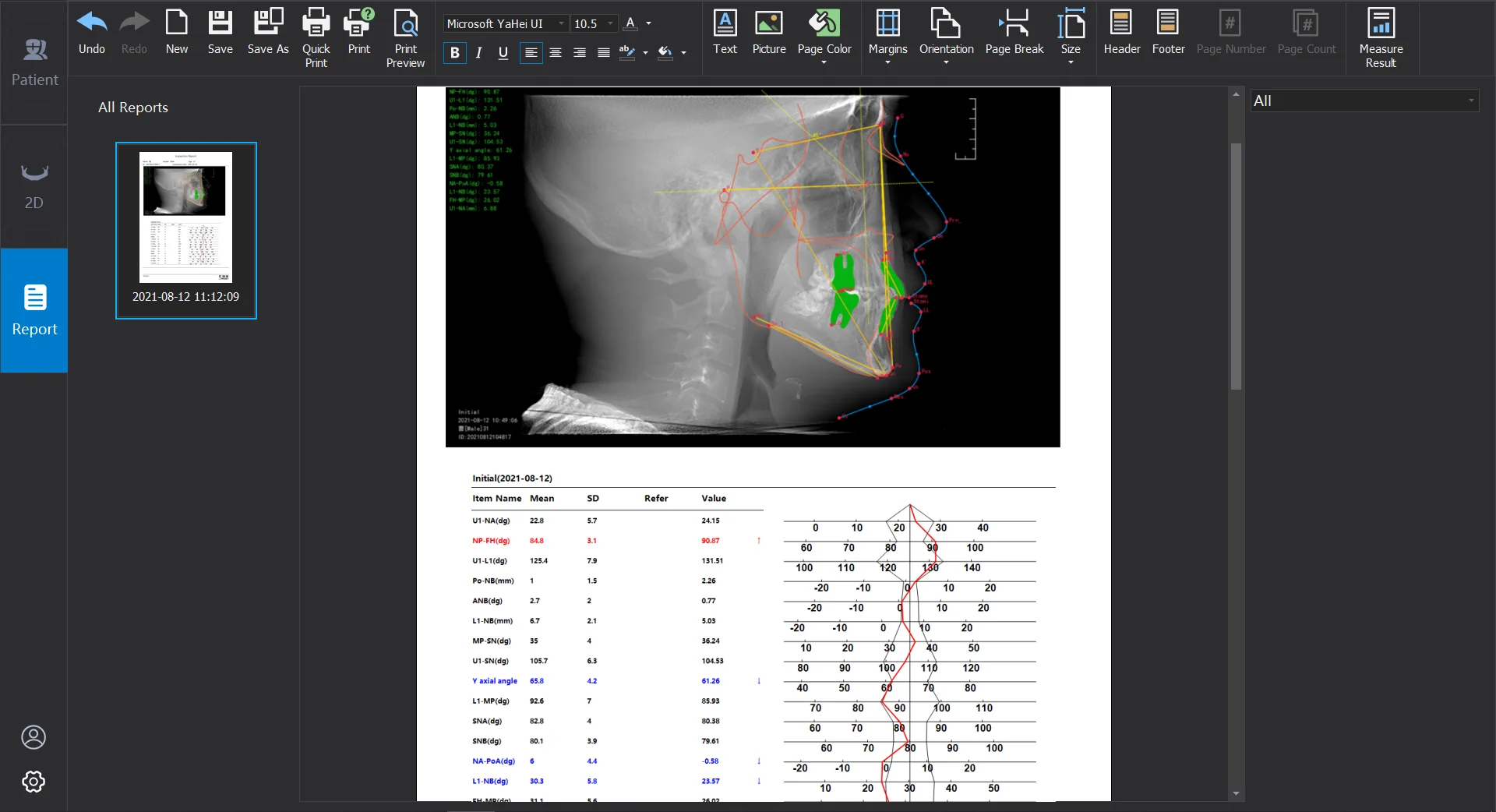  Ортодонтическое программное обеспечение CephPro3D для применения в стоматологии CBCT