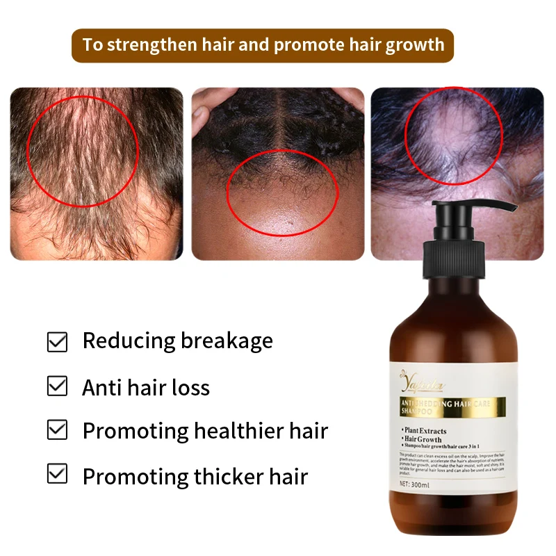 Free Sample Provide Wholesale Chinese Herbal Polygonum Multiflorum Fast Hair Growth Shampoo and Conditioner for Thinning Hair