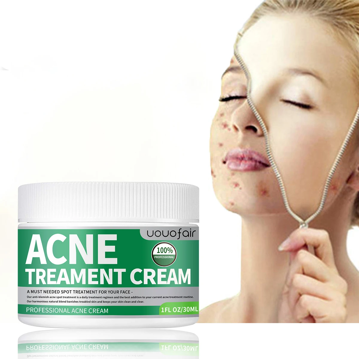 Day And Night Tea Tree Acne Remover Cream Effective Acne Scar Cream Pimple Removal New For Acne Face