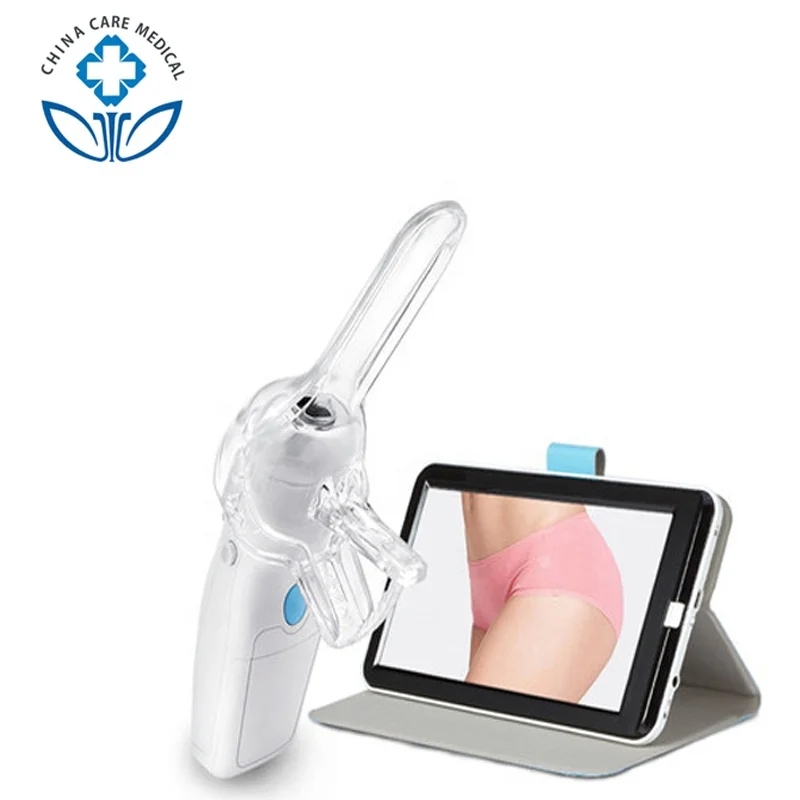 
Portable Electronic Mini Cervical Video Colposcopy Colposcope Culposcope Camera Machine Equipment For Gynecology In China 