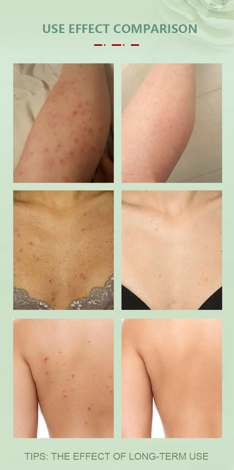 Skin Feel Renewed & Refreshed Natural Body Wash & Body Lotion Shower Gel With Bath Set