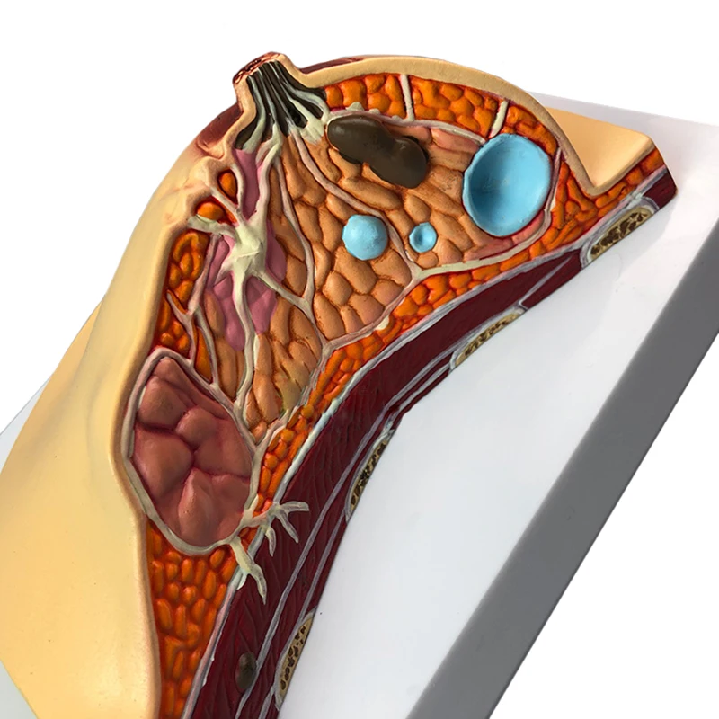 Medical Anatomy System Human Pathology Breast Model For Female Breast Healthy