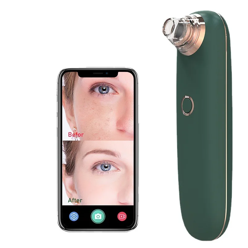  Electric usb charging skin care strip low noise blackhead remover Black Head Suction Extractor