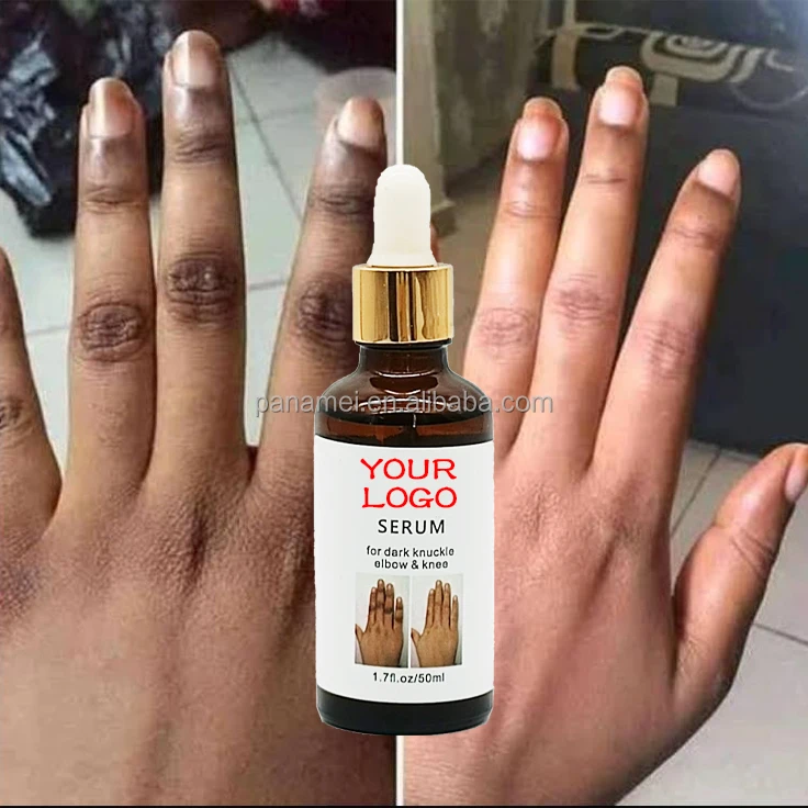 Best Selling Knee Elbow Dark Knuckle Removal Serum Strong Effective Knee Bleaching Whitening Serum for Skin Lightening