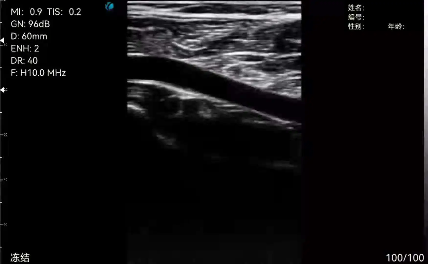 New Style 128 Elements Double Head Color Doppler Mini Wifi Handheld Wireless Ultrasound Probe medical ultrasound instruments