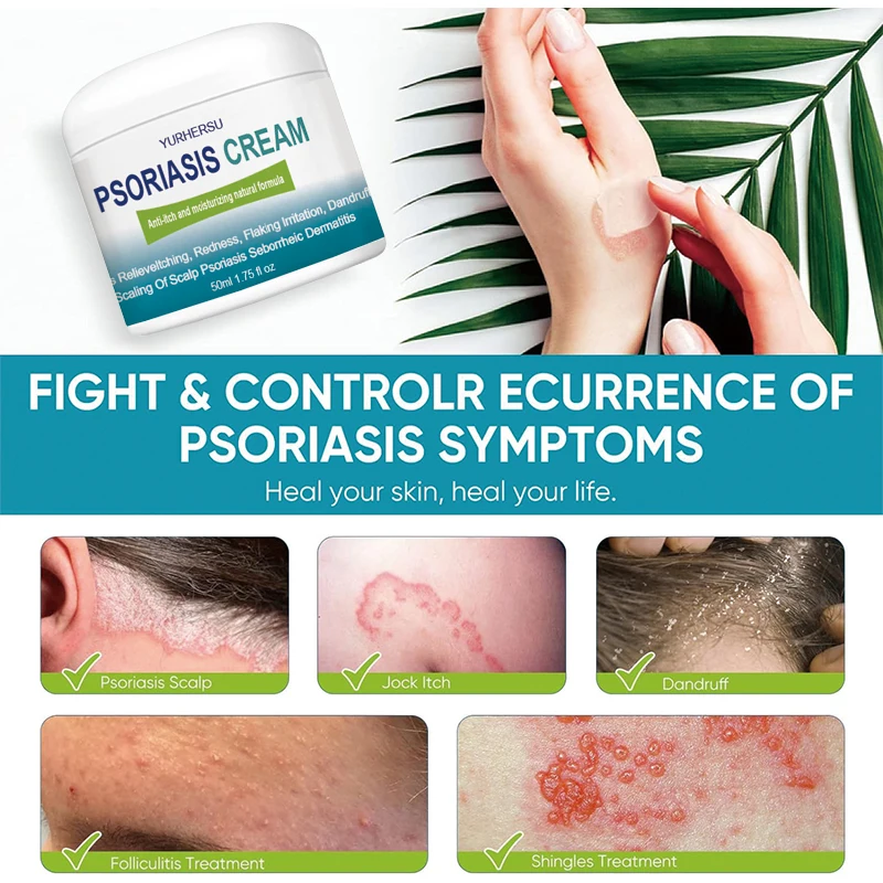 High Quality Natural Skin Care Treatment Psoriasis Eczema Herbal Cream