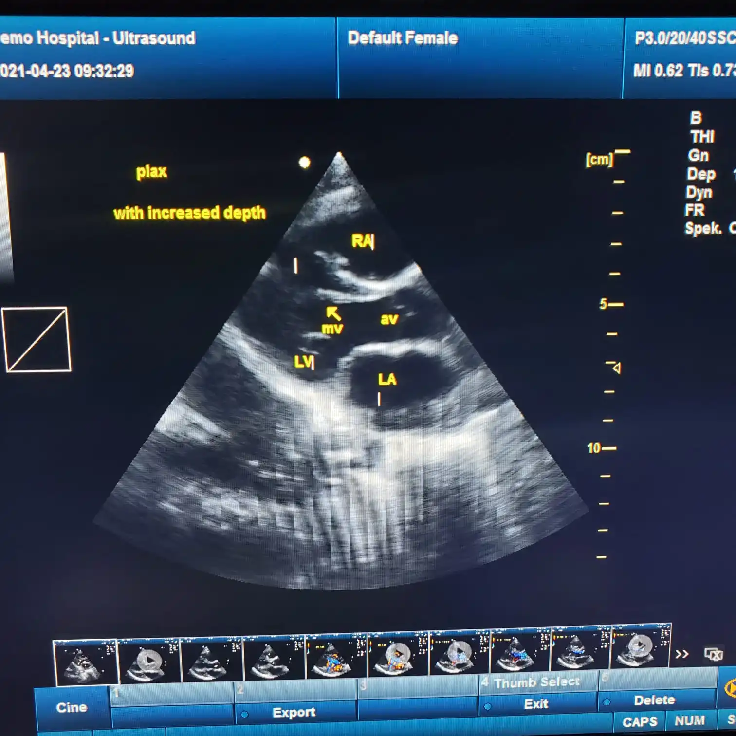 SUN-906B Portable Color Doppler scan High-end Rectal probe Veterinary ultrasound for pig sheep cattle goat