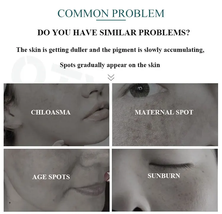 Copper peptide Retinol vitamin C E hyaluronic acid anti aging wrinkle Cream