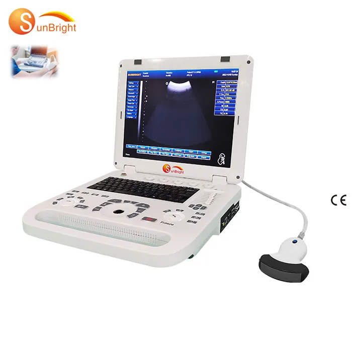 Automatic Identification Probe USG machine portable handheld Ultrasonic Diagnostic scanner