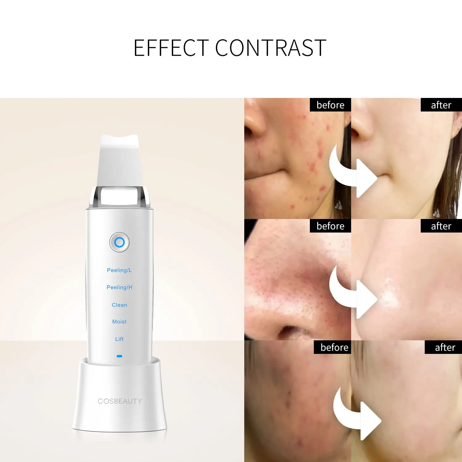 COSBEAUTY портативный Ионный ультразвуковой пилинг для лица, ультразвуковой шпатель для кожи, профессиональный скребок для кожи