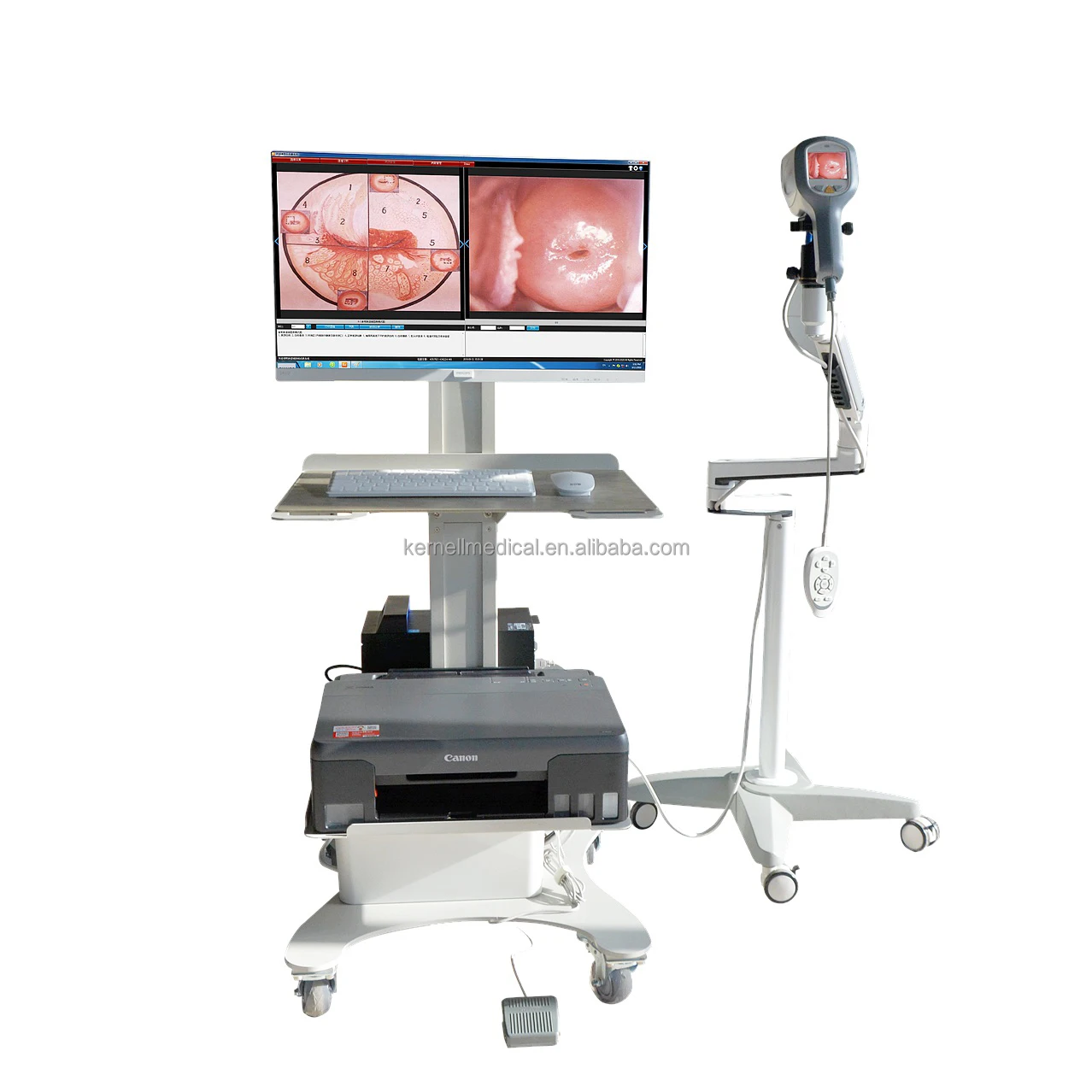 Kernel Optical colposcope Digital Video Vagina Colposcope KN-2200A Colposcope for Gynecology