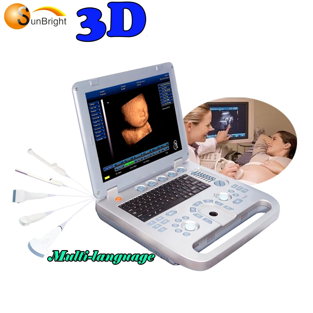  CE SUN-800D горячая Распродажа 15 дюймов Портативный портативных ПК 3D Груди УЗИ