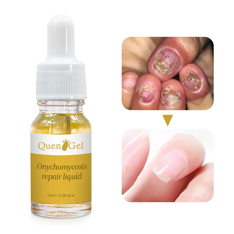 15 Fruity Art Nail Care Finger Nourishing Liquid Repair Moisturizing Armor Nutrition Pen 5Ml Nail Repair Cuticule Oil
