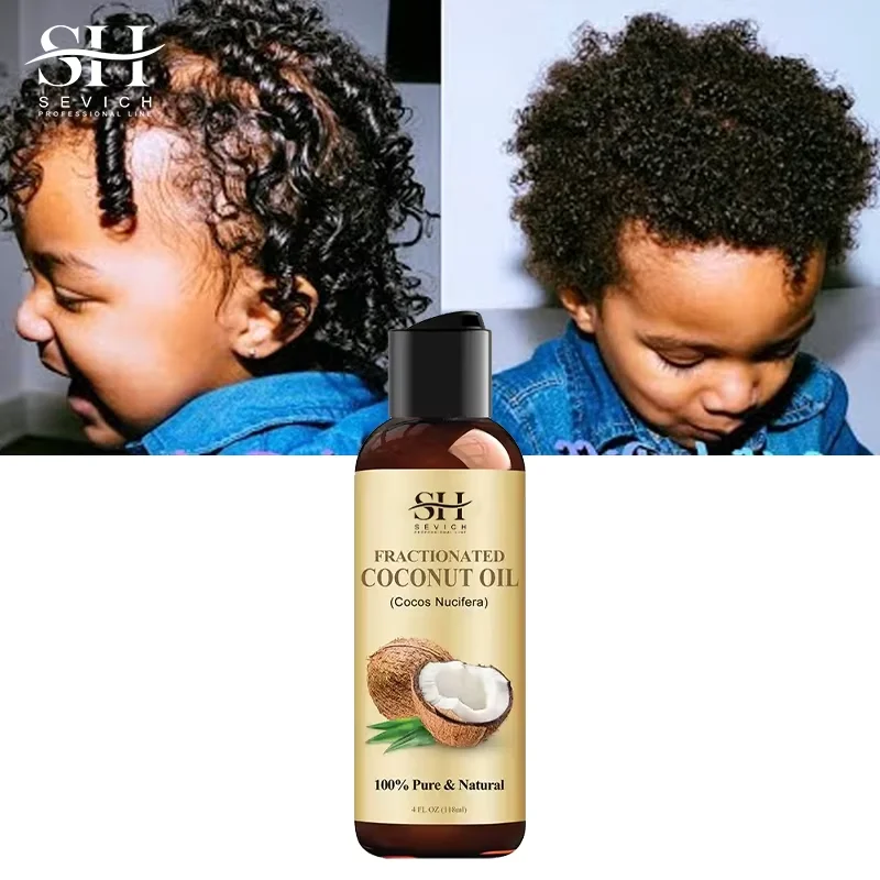 Private Label Natural Scalp Treatment Hair Care Repair Essential Refined Coconut Oil Fast Hair Growth Oil For Kids