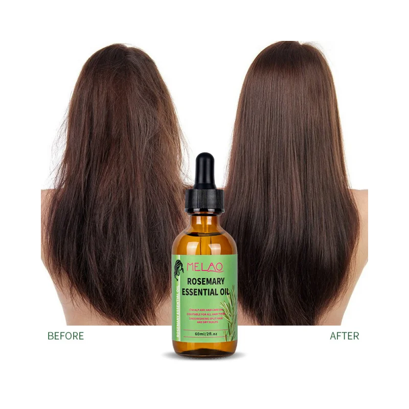 Private Label 100% Natural Organic Rosemary Castor Almond Oil Men Women Scalp Care Serum Hair Treatment Growth Oil