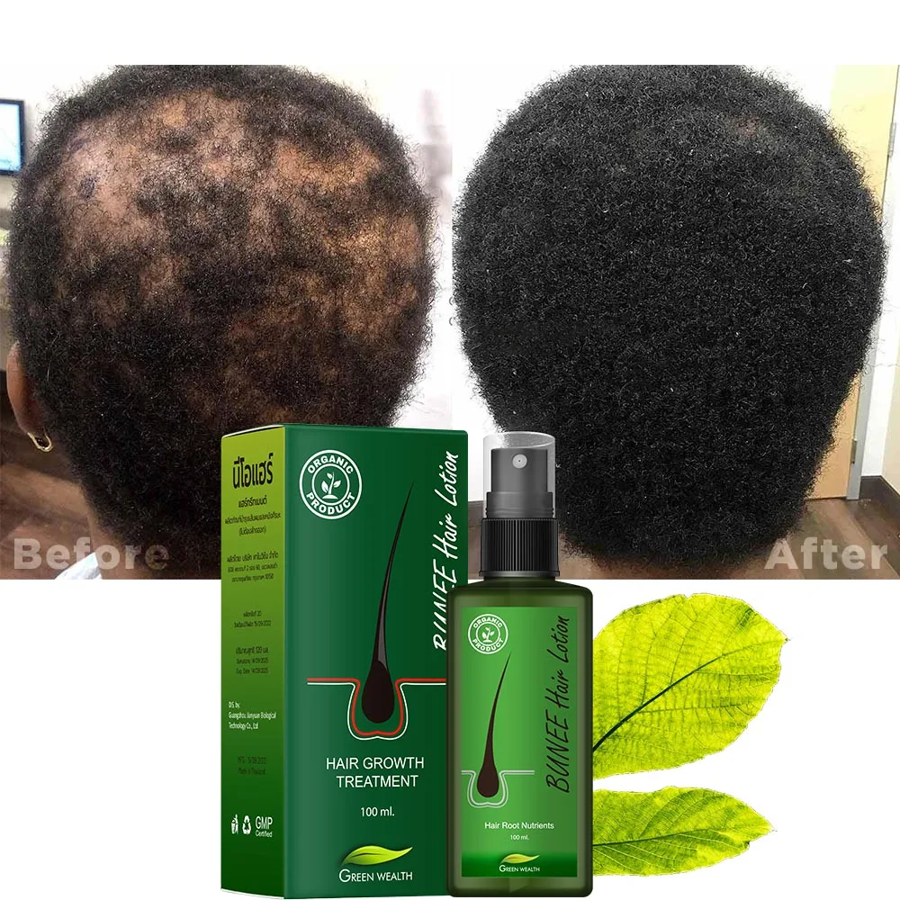 Hot selling BUNEE hair lotion fast anti hair loss and help hair growth from Thailand