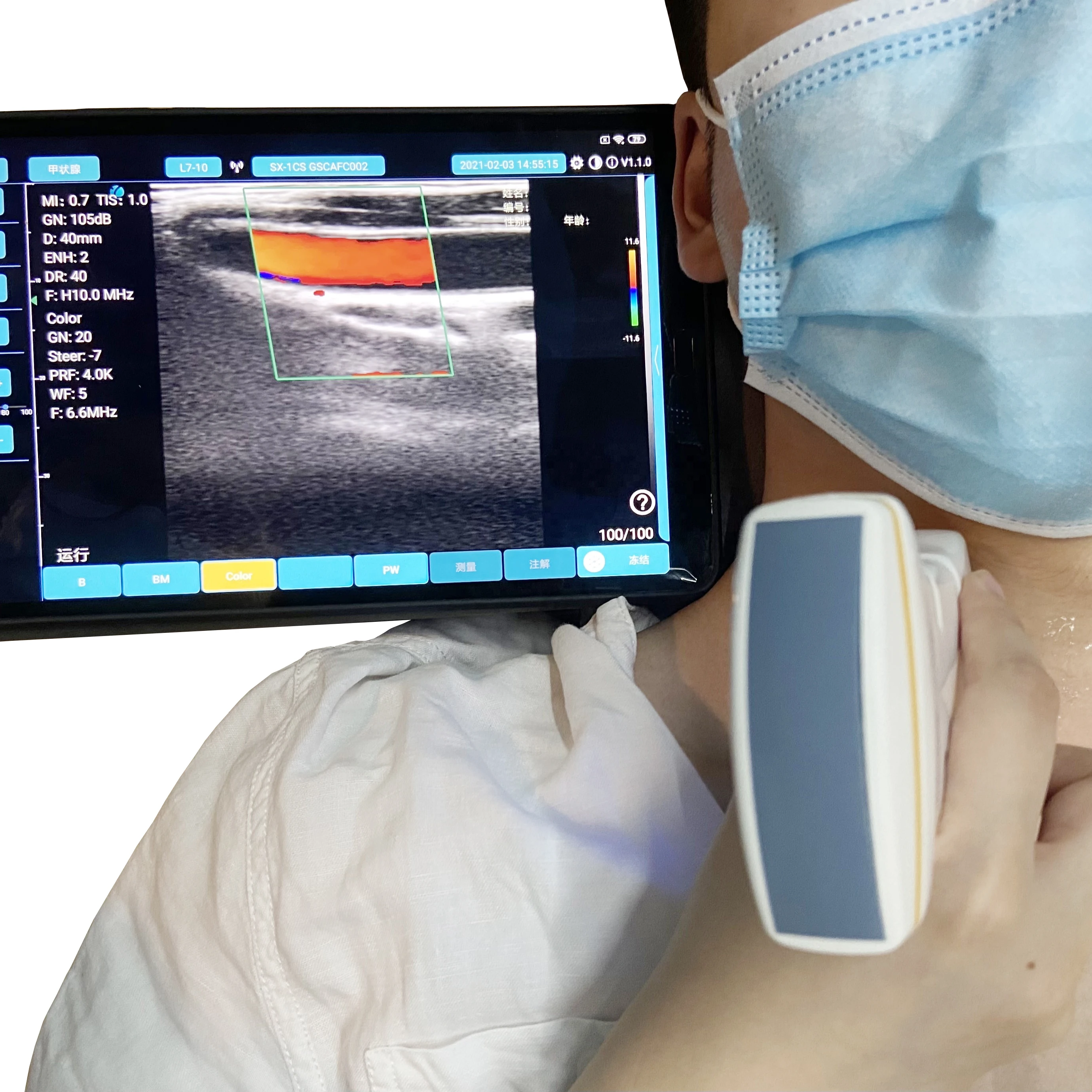 New Style 128 Elements Double Head Color Doppler Mini Wifi Handheld Wireless Ultrasound Probe medical ultrasound instruments