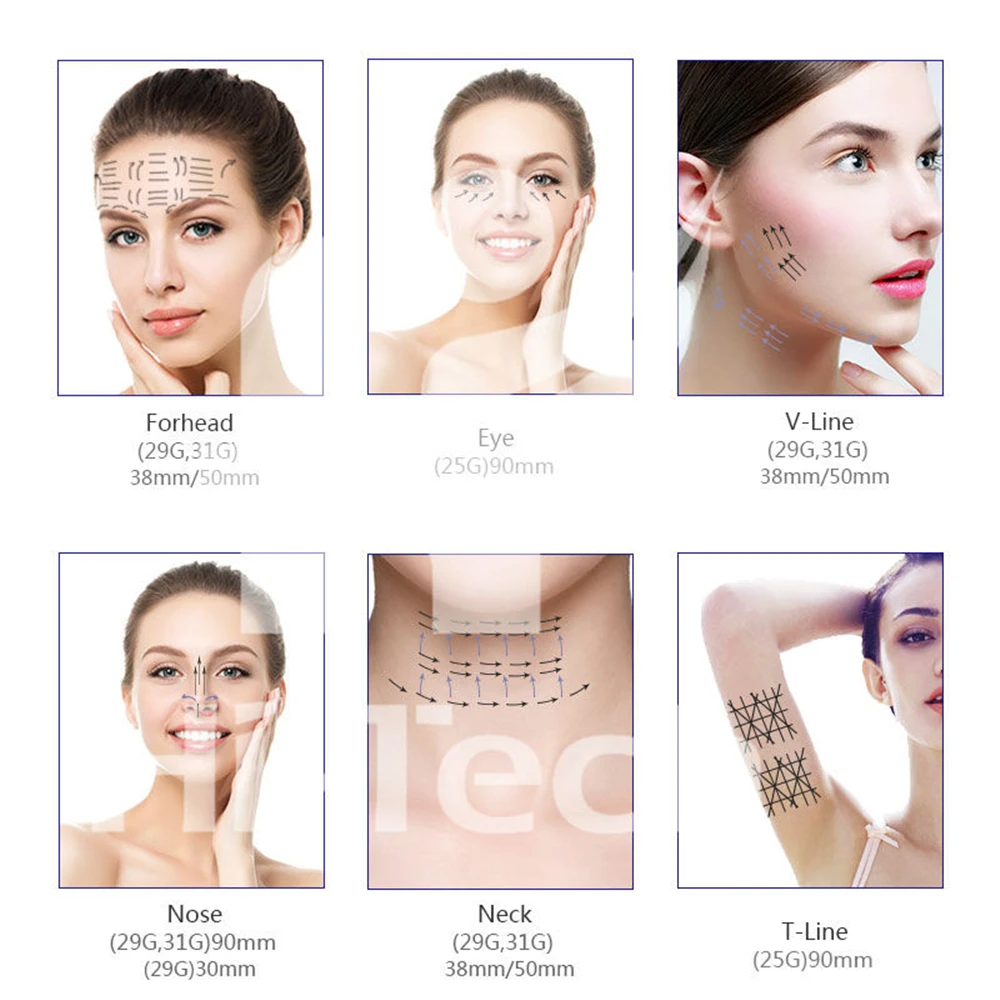 Pdo Thread Lift Korea V Lifting Nose Mono 3d 4d 6d Face Lifting Thread Pdo Plla Pcl Cog Threads