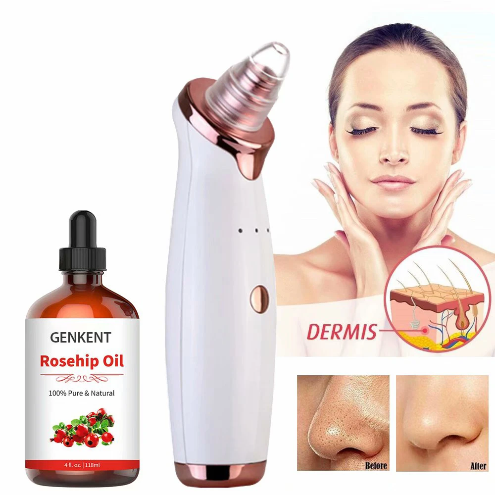 Private label 100% Pure Cold Pressed Unrefined Reduce Acne Scars Rosehip Seed Oil Pure Essential Oil