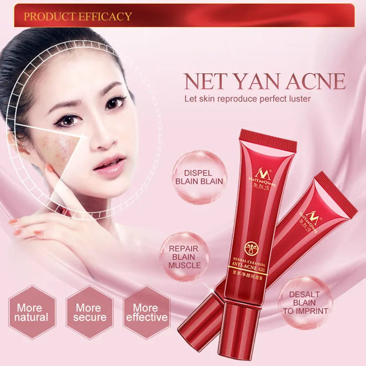 Hot Selling More Effective Aloe Acne Cream Acne Removal  Cream