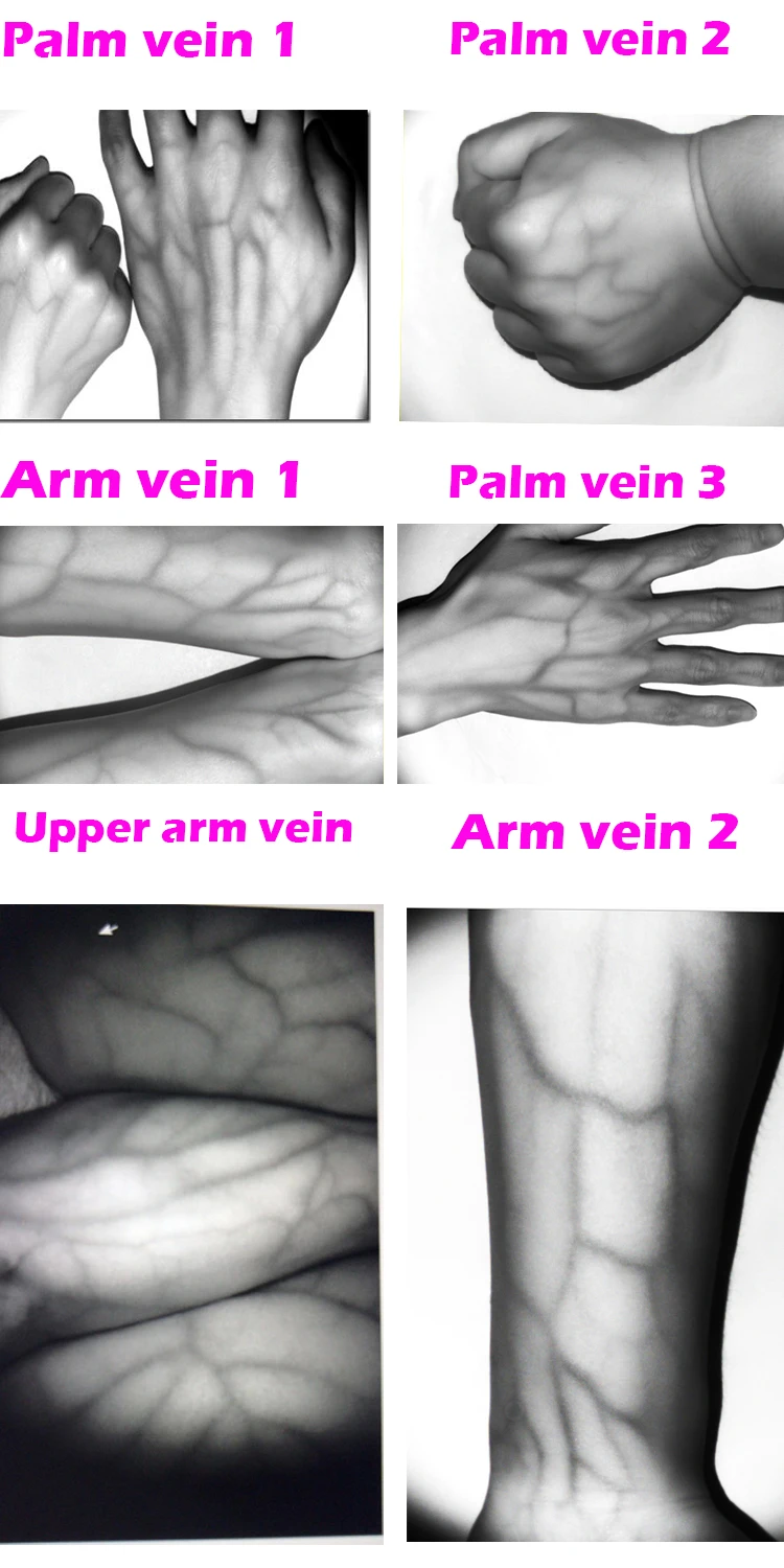 
High Clearly Clinical Vein Imaging Device LCD Display Vein Finder 