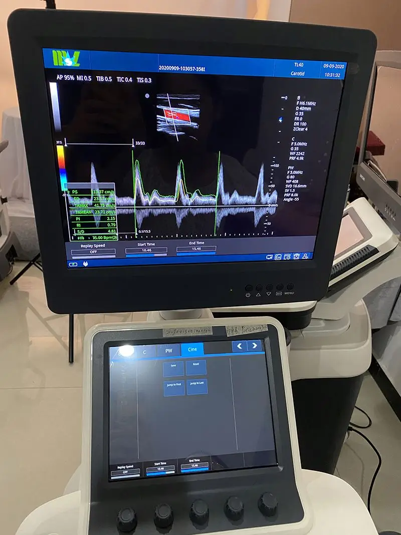 Медицинская ультразвуковая 3D 4D цветная допплеровская диагностическая система Medsinglong MSLCU46