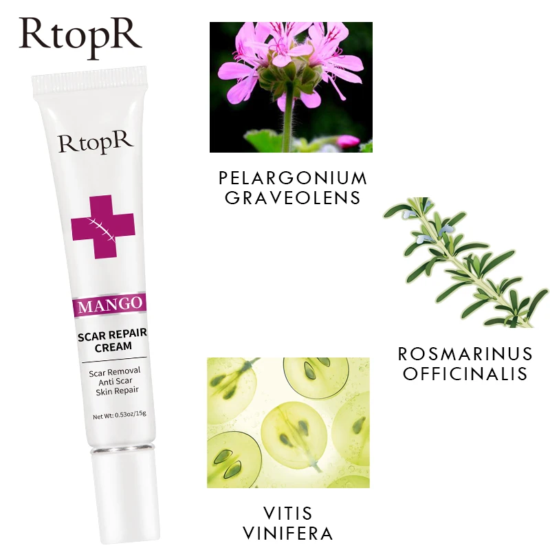 RtopR Acne Scar Stretch Marks Remover Cream Skin Repair Face Cream Acne Spots Acne Treatment Blackhead Whitening Cream Skin Care